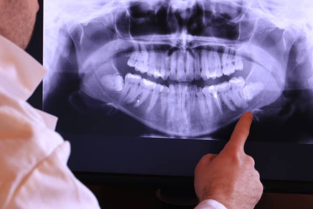 Best Cracked Tooth Emergency Dentist  in Lewisville, WA