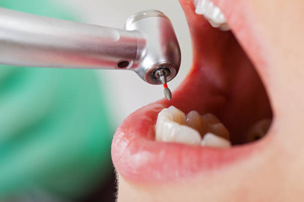 Best Dentist Open Late Near Me  in Lewisville, WA